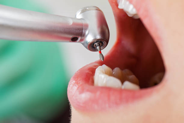 Best Emergency Treatment for Dental Infections or Abscesses in Village Of Oak Creek, AZ
